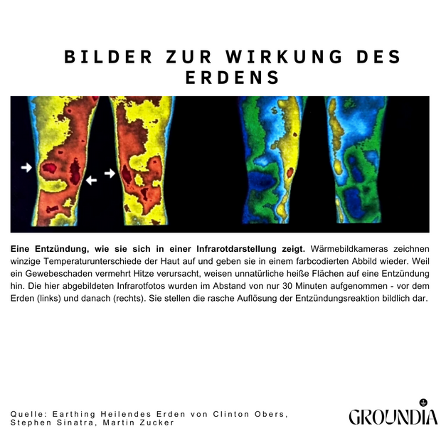 GROUNDIA - Erdungskissen
